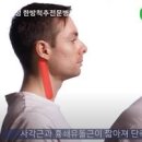 일자목 거북목 원인 증상 해결책 치료 교정 운동 이미지