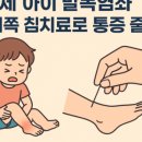 절룩거리며 걸어왔어도, 발목 골절일 수 있습니다 – 오타와 룰과 초음파 검사 사례 (2)