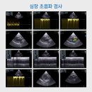 오산동물병원 | 오산동물병원 강아지 심장병 진단 심장 초음파 검사 후기