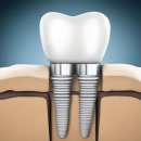 충정로예치과의원 이미지