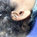 시그니아독일보청기 동작센터 이미지