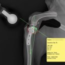 라온 동물 메디컬센터 | TPLO 수술 후 레이저 치료로 회복을 빠르게 – TPLO 수술 후기 - 울산 중구 동물병원 라온동물메디컬센터