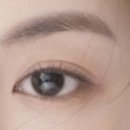 쌍수 손품 발품 후기 체크리스트 블랙리스트