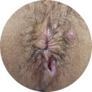 우리항외과의원 | 치루수술 받아봄 간단후기 청주 우리항외과 (내돈내산)