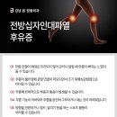 백제정형외과의원 | 전방십자인대 부분파열 병원 선택과 재활