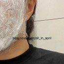 거금의원 | [뷰티라운지 창원점] 내돈내산 리쥬란HB 솔직후기
