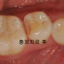 마산탑치과의원 이미지