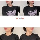아로마벨피부과의원 | 창원피부과 슈링크 400샷 후기 슈링크잘하는곳 추천