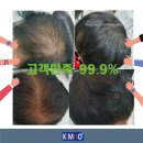김호증모가발·소호헤어