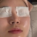 가람메디컬 | 영주 윤스킨 방문 후기✨ AI 피부 진단부터 재생관리까지 90분 감동 케어!