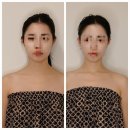 [ 웨딩 / 신부 관리 ] : Yourehap Aesthe 유리햅에스떼 인천 부평구 십정동 백운역 에스테틱