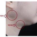 예쁜브이라인의원 이미지