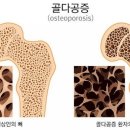 좋은아침의원 이미지