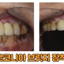 더하얀치과 이미지