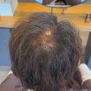 부산 탈모 디자인 염색 추천 | 얇아진 정수리, 자연스럽게 커버한 50대 남성 시술 후기 (피가로 디자이너)