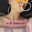 웰뷰파크 | 인계동 피부관리 | 나만 알고싶은 &#39;웰뷰티힐러 스킨&amp;바디&#39; 얼굴 윤곽 관리 솔직 후기!!