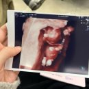 송도의원 | (12주2일) 송도 곽생로여성의원 1차 기형아검사 후기