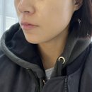 전주중화산동피부샵 The가꾸다에서 하이푸리프팅 받고 온 후기