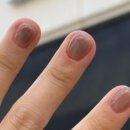 도농건강약국 | 도농역네일 가을네일컬러추천 문제성발톱네일룸
