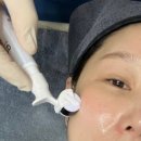 블랙라벨 | 강남역 엑소좀 스킨부스터 효과 큐티셀 블랙라벨 후기