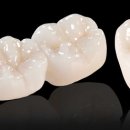 다이아몬드치과기공소 이미지