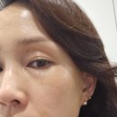 베아므 이미지