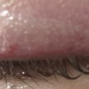 컴포트성형외과의원 이미지