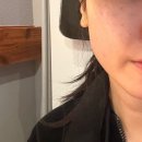 세포 | 센텀피부과 줄기세포 후기