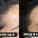 헤어;나봄