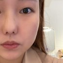 엑소리젠 토탈뷰티
