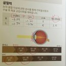 청산약국 | 라식 후기