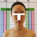 경락관리 이미지
