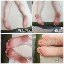 대전 대덕구 송촌동 피부관리 다경미힐링스킨앤바디 만족후기!