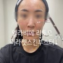 엘리샤 뷰티 | 엘라비에 리투오 효과 압구정피부과에서 미라젯 스킨부스터 받고 온 찐 후기 (모공, 탄력 개선)