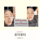 로이뷰티 | 강북피부관리 로이뷰티 물광필관리후기