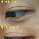 굿바이콤플렉스 이미지