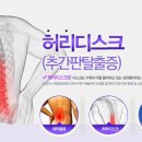 요추 4번. 5번 허리디스크 자석 복합요법 치유사례 이미지