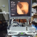 Olympus BF-1T260 Bronchoscope 이미지