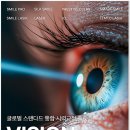 스마일 종합환경 | 스마일라식 후기보다 먼저 봐야 할 부작용 확인 기준