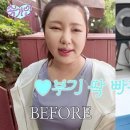 온더볼운동 이미지