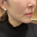 (주)에이피알 | [찐리뷰/내돈내산]에이피알 메디큐브 에이지알 부스터 프로 달 사용후기