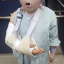 씨유상주적십자병원앞점 | 소아 팔꿈치 골절 수술_서울원병원 후기(25.05)