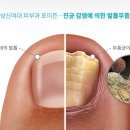 포이즌의원 이미지