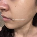 제이에이치드림 | 아롱이의 삼전역피부관리 올가드림뷰티 삼전점 물광관리 후기