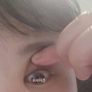 컴포트성형외과의원 이미지