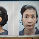 청담차오름의원 이미지