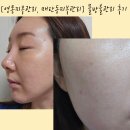 [영통피부관리] 예쁜아침 물방울관리, 재생관리, 매끈해진 피부 후기
