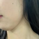 두잇핏PT | [서울/관악구]서울대입구역pt<코어핏>1대1pt후기!(비포&amp;애프터 사진 있음)