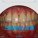 조성주치과의원 네이버블로그