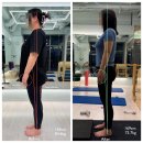 물리치료사의 바디포스쳐 PT 이미지